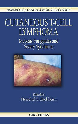 E-Book (pdf) Cutaneous T-Cell Lymphoma von 