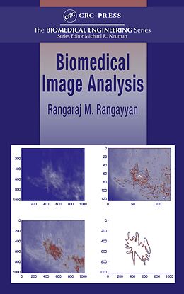 eBook (pdf) Biomedical Image Analysis de Rangaraj M. Rangayyan