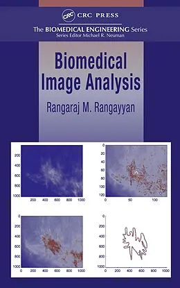 E-Book (pdf) Biomedical Image Analysis von Rangaraj M. Rangayyan