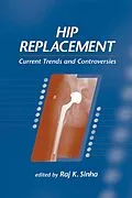 E-Book (pdf) Hip Replacement von Raj K. Sinha