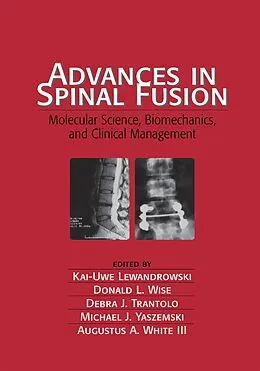 E-Book (pdf) Advances in Spinal Fusion von Kai-Uwe Lewandrowski