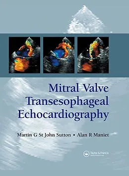 E-Book (pdf) Mitral Valve Transesophageal Echocardiography von Martin G. St. John Sutton, Alan R. Maniet