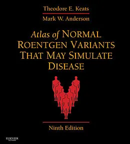 E-Book (epub) Atlas of Normal Roentgen Variants That May Simulate Disease E-Book von Theodore E. Keats MD, Mark W. Anderson MD