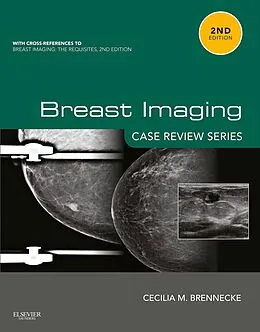 E-Book (epub) Breast Imaging: Case Review Series E-Book von Cecilia M Brennecke MD
