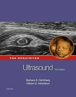 E-Book (epub) Ultrasound: The Requisites von Facr Hertzberg MD, Facr Middleton MD