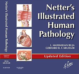 eBook (epub) Netter's Illustrated Human Pathology Updated Edition E-book de L. Maximilian Buja, Gerhard R. F. Krueger