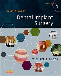 E-Book (epub) Color Atlas of Dental Implant Surgery - E-Book von Michael S. Block DMD