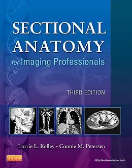 E-Book (epub) Sectional Anatomy for Imaging Professionals - E-Book von Rt(R) Kelley, Rt(R) Petersen