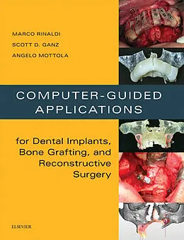 E-Book (epub) Computer-Guided Dental Implants and Reconstructive Surgery von Marco Rinaldi, Scott D Ganz, Angelo Mottola