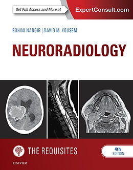 E-Book (epub) Neuroradiology: The Requisites E-Book von Rohini Nadgir, David M. Yousem