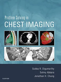 E-Book (epub) Problem Solving in Chest Imaging E-Book von Subba R. Digumarthy MD, Facr Abbara MD, Jonathan H. Chung MD