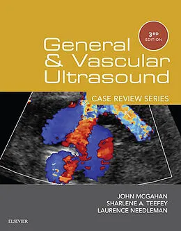 E-Book (epub) General and Vascular Ultrasound: Case Review Series E-Book von John P. McGahan MD, Sharlene A Teefey MD, Laurence Needleman MD