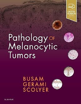 Fester Einband Pathology of Melanocytic Tumors von Klaus J. Busam, Pedram Gerami, Richard A. Scolyer
