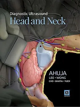 E-Book (pdf) Diagnostic Ultrasound: Head and Neck von Anil T. Ahuja