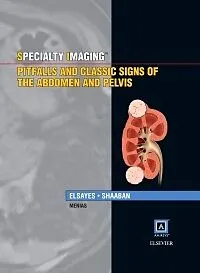 E-Book (pdf) Specialty Imaging: Pitfalls and Classic Signs of the Abdomen and Pelvis von Khaled M Elsayes