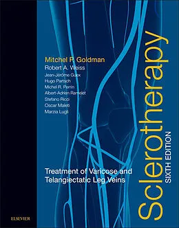 E-Book (epub) Sclerotherapy E-Book von Mitchel P. Goldman MD, Robert A Weiss MD