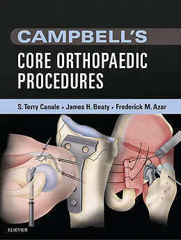 E-Book (epub) Campbell's Core Orthopaedic Procedures E-Book von S. Terry Canale MD, James H. Beaty MD, Frederick M. Azar MD
