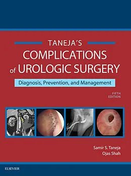 E-Book (epub) Complications of Urologic Surgery E-Book von Samir S. Taneja MD, Ojas Shah MD