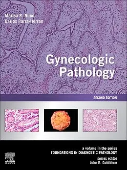 E-Book (epub) Gynecologic Pathology E-Book von Marisa R. Nucci MD