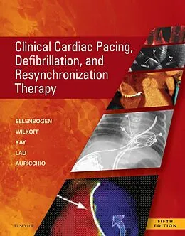 E-Book (epub) Clinical Cardiac Pacing, Defibrillation and Resynchronization Therapy E-Book von Kenneth A. Ellenbogen MD, Bruce L. Wilkoff MD, G. Neal Kay MD