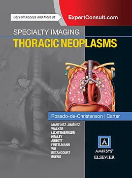 E-Book (epub) Specialty Imaging: Thoracic Neoplasms E-Book von Facr Rosado-de-Christenson MD, Brett W. Carter MD