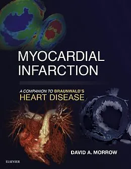 E-Book (epub) Myocardial Infarction: A Companion to Braunwald's Heart Disease E-Book von Mph Morrow MD
