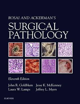 E-Book (epub) Rosai and Ackerman's Surgical Pathology E-Book von John R. Goldblum, Laura W. Lamps, Jesse K. McKenney