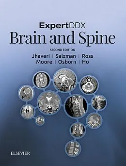 E-Book (epub) ExpertDDx: Brain and Spine E-Book von Karen L. Salzman, Miral D. Jhaveri, Jeffrey S. Ross