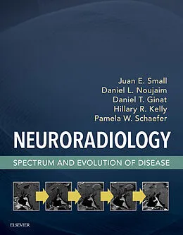 E-Book (epub) Neuroradiology von MSc Small MD, Daniel L. Noujaim MD, Ginat MD