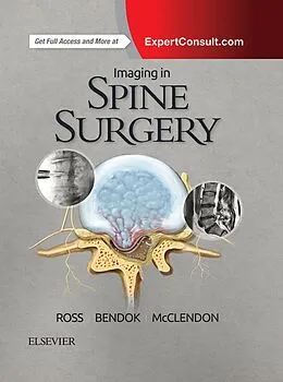 E-Book (epub) Imaging in Spine Surgery E-Book von Jeffrey S. Ross MD, Faans Bendock MD, Jamal McClendon Jr. MD
