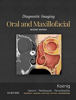 E-Book (epub) Diagnostic Imaging: Oral and Maxillofacial E-Book von Dds Koenig BChD, DMSc Tamimi BDS, MSc Perschbacher DDS