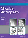 E-Book (epub) Shoulder Arthroplasty E-Book von T. Bradley Edwards MD, Brent J. Morris MD