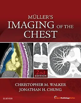 E-Book (epub) Muller's Imaging of the Chest E-Book von Christopher M. Walker MD, Jonathan H. Chung MD