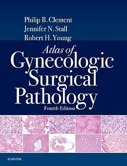 E-Book (epub) Atlas of Gynecologic Surgical Pathology E-Book von Philip B. Clement MD, Jennifer Stall MD, FRCPath Young MD