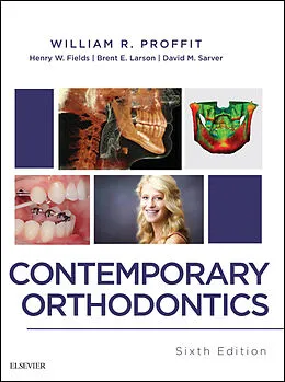 E-Book (epub) Contemporary Orthodontics - E-Book von Proffit DDS, Fields DDS, Larson DDS