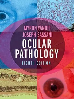 E-Book (epub) Ocular Pathology von Myron Yanoff MD, Mha Sassani MD