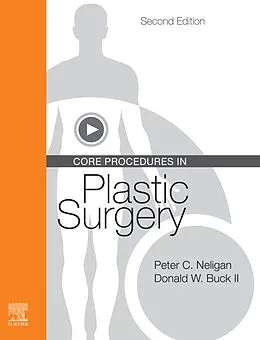 E-Book (epub) Core Procedures in Plastic Surgery E-Book von Frcs(I) Neligan MB, Facs Buck II MD