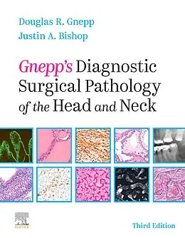 E-Book (epub) Gnepp's Diagnostic Surgical Pathology of the Head and Neck E-Book von Douglas R. Gnepp MD, Justin A. Bishop MD