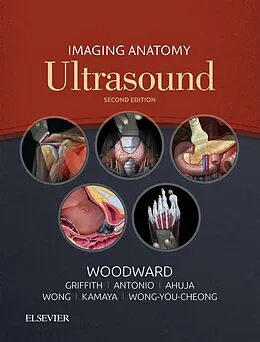 E-Book (epub) Imaging Anatomy: Ultrasound E-Book von Paula J. Woodward, James Griffith, Gregory E. Antonio