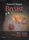 E-Book (epub) Diagnostic Imaging: Breast E-Book von Wendie A. Berg, Jessica Leung