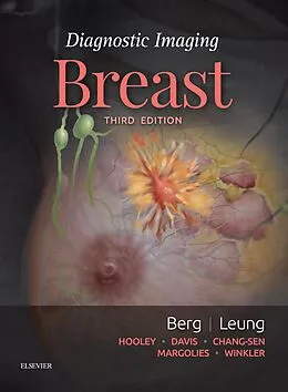 E-Book (epub) Diagnostic Imaging: Breast E-Book von Wendie A. Berg, Jessica Leung