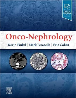 E-Book (epub) Onco-Nephrology E-Book von Kevin W. Finkel, Mark Anthony Perazella MD, Eric P Cohen MD