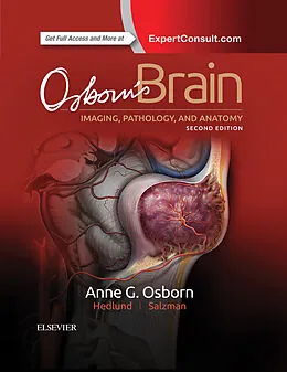 E-Book (pdf) Osborn's Brain E-Book von Facr Osborn MD, Gary L. Hedlund DO, Karen L. Salzman MD