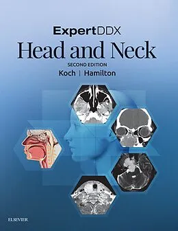 E-Book (epub) ExpertDDX: Head and Neck von Bernadette L. Koch, Bronwyn E. Hamilton