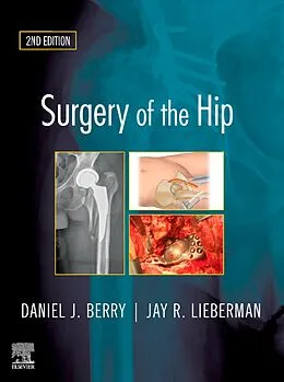 ePUB Surgery of the Hip von Daniel J. Berry, Jay Lieberman