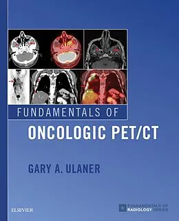 E-Book (epub) Fundamentals of Oncologic PET/CT E-Book von Ulaner MD