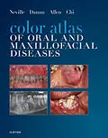 E-Book (epub) Color Atlas of Oral and Maxillofacial Diseases - E-Book von Brad W. Neville DDS, Douglas D. Damm DDS, Msd Allen DDS