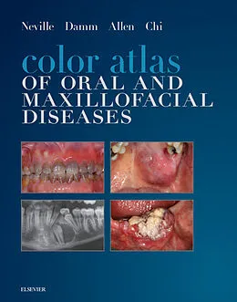 E-Book (epub) Color Atlas of Oral and Maxillofacial Diseases - E-Book von Brad W. Neville DDS, Douglas D. Damm DDS, Msd Allen DDS