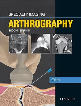 E-Book (epub) Specialty Imaging: Arthrography E-Book von Julia R. Crim MD