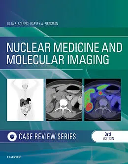 E-Book (epub) Nuclear Medicine and Molecular Imaging: Case Review Series E-Book von Mba Solnes MD, Harvey A. Ziessman MD